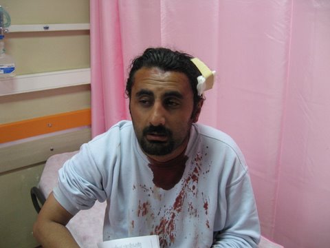 Sivas'taki Faşist Saldırının Fotoğrafları
