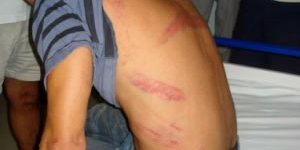 "Karakolda dayak" iddiası