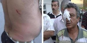 Zabıta dayağı Bakırköy'de hortladı