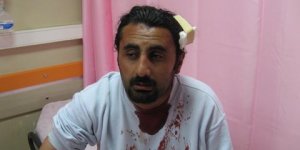 Sivas'taki Faşist Saldırının Fotoğrafları