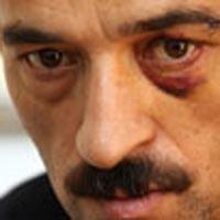 Keçiören'deki içki dayağına ABD'den inceleme