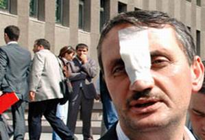 İkinci Metin Şahin Vakası: Bir Alevi Esnafa Daha İçki Dayağı