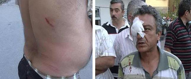 Zabıta dayağı Bakırköy'de hortladı 